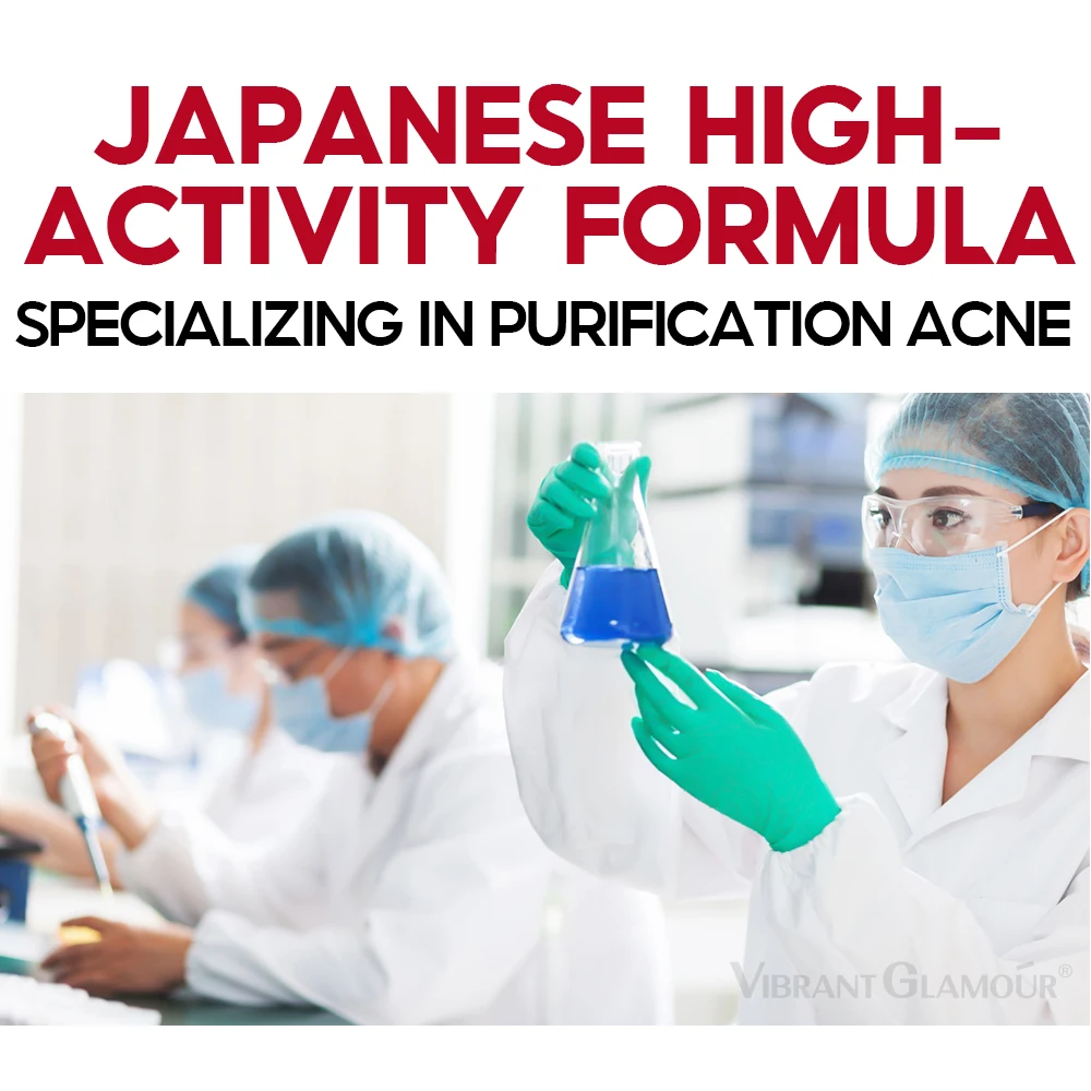 VIBRANT GLAMOUR Salicylic Acid Acne Handmade Soap Cleanses Pores Inhibits Acne Anti-Inflammatory Soothing  100g 3
