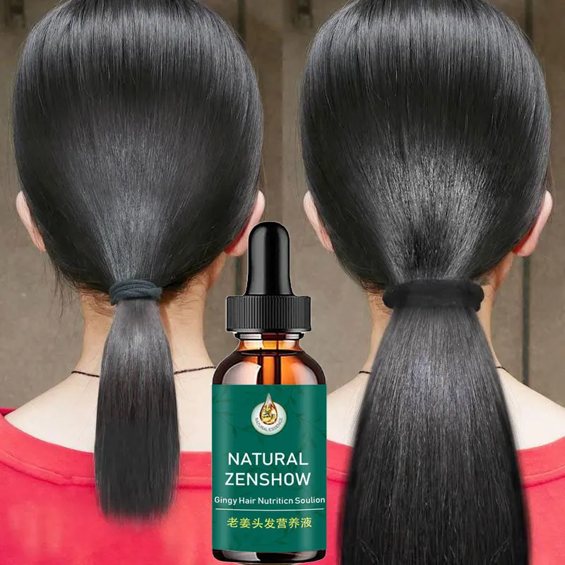 Ginger Hair Growth Serum Conditioner Anti-Hair Loss Essential Oils Improves Hair Follicles Nourishes Hair Roots Thick Hair