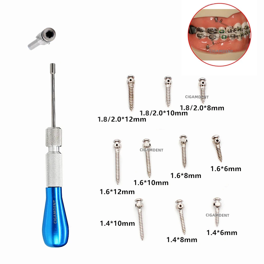 

Dental Orthodontic Mini Implant Micro Screws Titanium Alloy Implant Screwdriver Self-Drilling 1.4mm/1.6mm/1.8mm/2.0mm