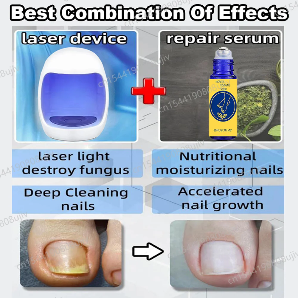 Professional Nail Tools For Nails Care And Repair Inhibiting Fungi To Solve Onychomycosis And Paronychia