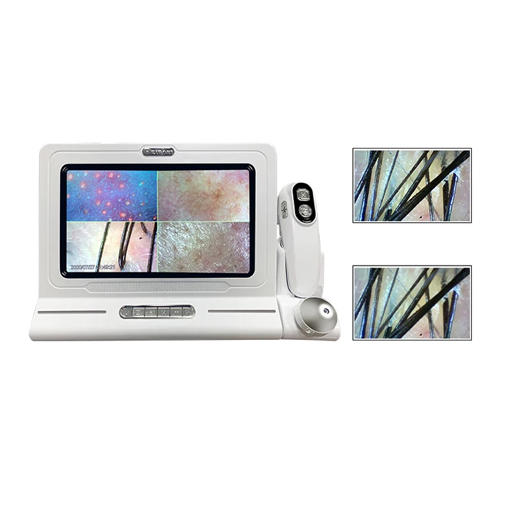 

hair scalp detector wifi scalp hair follicle skin detector