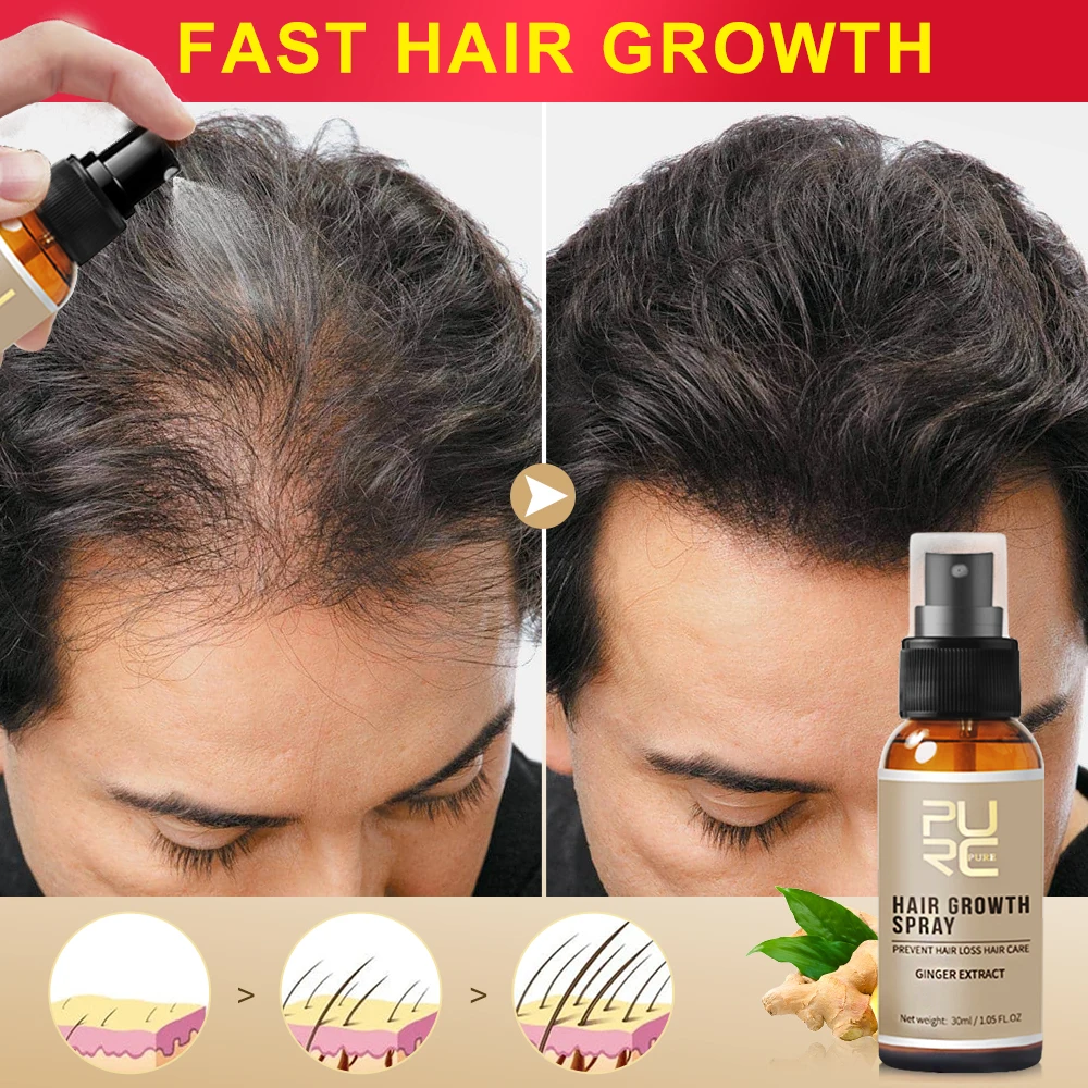 Breathtaking Purc Hair Growth Spray Landscape Concept Breathtaking Purc Hair Growth Spray Landscape Concept