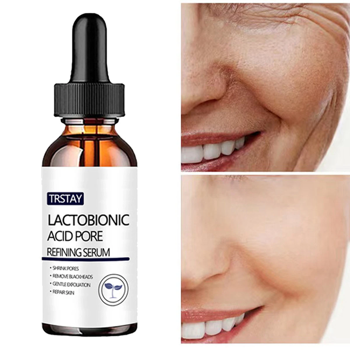 חומצה לקטית חיידקים נקבוביות תמצית יכול לדעוך כתמים, לכווץ נקבוביות, להאיר את צבע העור ואת שמן שליטה