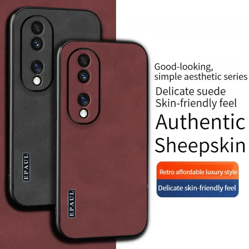 Étui en cuir élégant pour Huawei Honor 90 80 GT 70 60 SE Pro Plus Magic 5 4 X50i Play 7T 40 30 - Coque de téléphone en peau de mouton_voghion.com