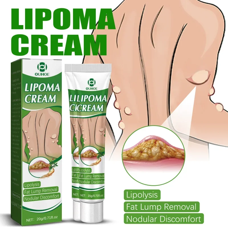 

Lipoma Removal Cream Remove Fat Mass Nodules Skin Tumor Swelling Pain Ointment Plaster Relief Exfoliating Cellulite Body Care