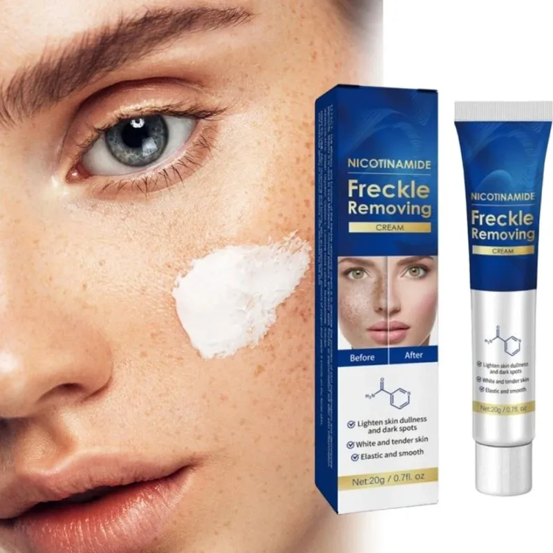 

Effective Remover Dark Melasma Chloasma Senile Plaques Sunburn Brighten Moisturizing Nourishing Cream Skin Lifting Cream