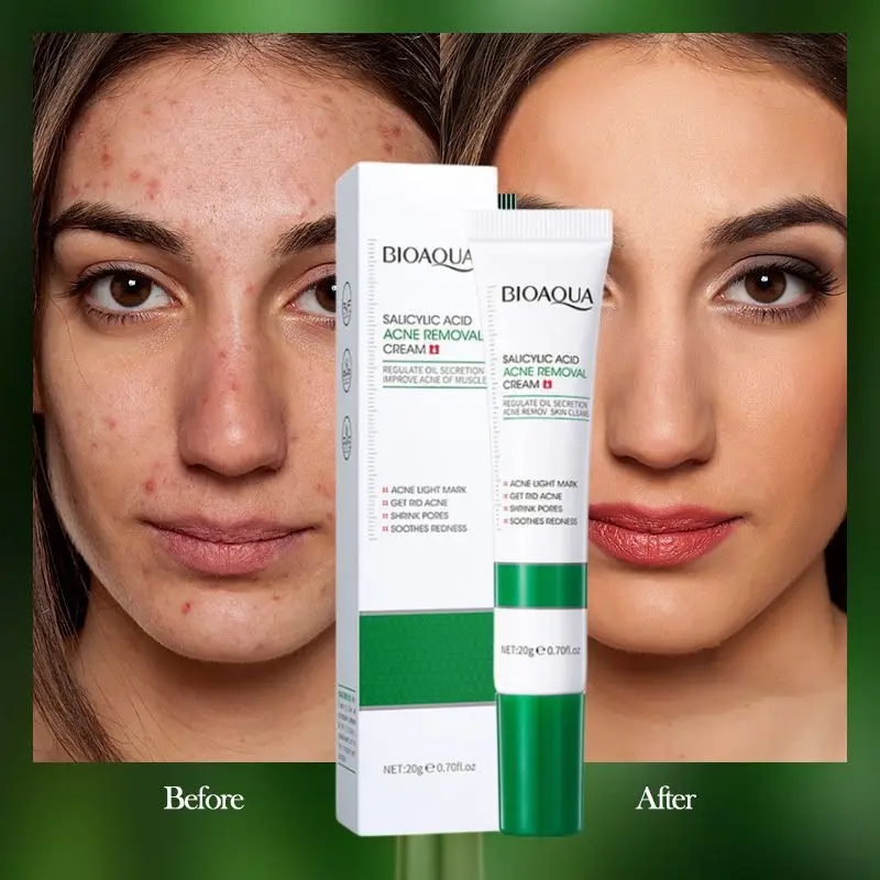 

1-10 шт., увлажняющий крем для лица, с салициловой кислотой