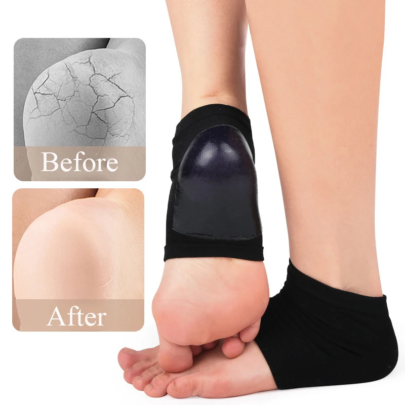 

1 Pair New Gel Heel Socks Moisturing Spa Gel Socks Feet Care Cracked Foot Dry Hard Foot Skin Care Protectors Foot Care Tool