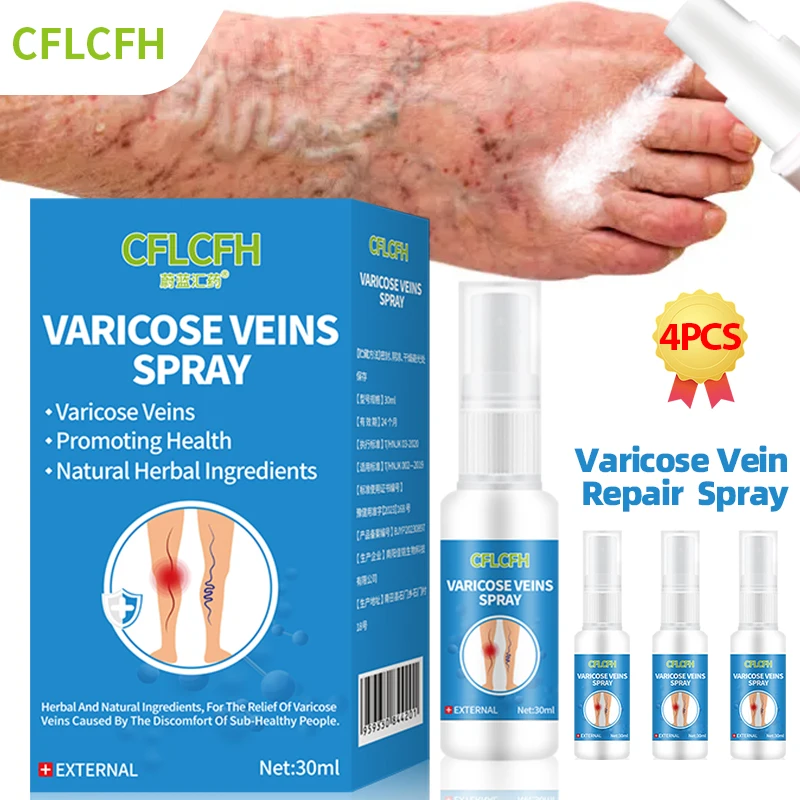 

Varicose Veins Treatment Spray Leg Dilated Spider Legs Varicosity Vasculitis Phlebitis Angiitis Relief Foot Care Medicine Liquid