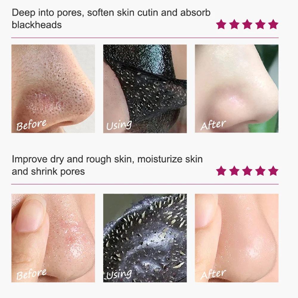 Рисунок 6 - Маска для удаления черных точек на носу