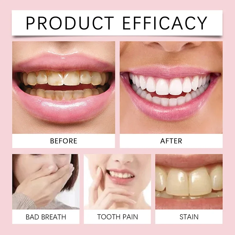 SP-6 Probiotic Toothpaste Whiten Clean Teeth Remove Stains Oral Care Management Fresh Breath With Sodium Saccharin Lactobacillus teeth whitening product teeth health product