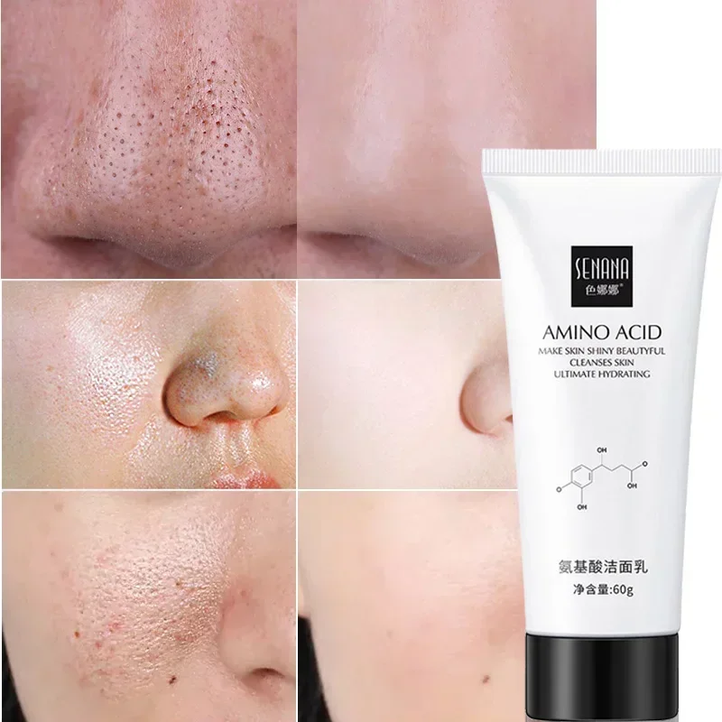 Nicotinamide Amino Acid Face Cleanser Facial Scrub Cleansing Acne Oil Control Blackhead Remover Shrink Pores Skin Care 2