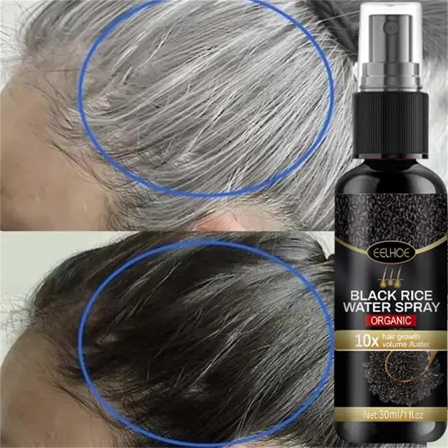 Gray White Hair Treatment Serum White To Black Natural Color Repair Spray Fast Hair Growth Products Anti Hair Loss Care Products