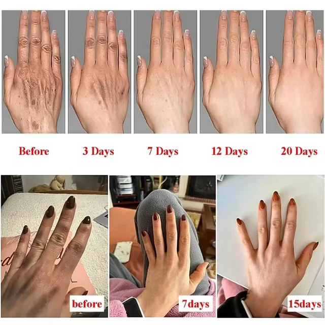 Hyaluronic Acid Anti-Wrinkle Hand Serum Cream Skin Soften Nourish Anti-Drying Whiten Moisturizing Cracked Repair Products Korean 2