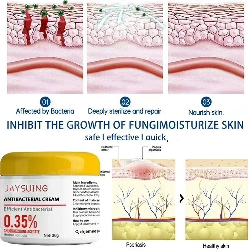 Massage Relaxation Gel Cold Compress Gel Relieve Muscle and Joint Pain Body Care Massage Cream