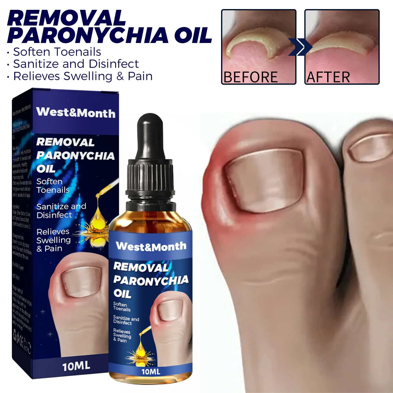 

Toenailcare Removal Paronychia Oil Ingrown Toenail Treatment Best Nail Repair Solution Nail Renewal Liquid masajeador de pies