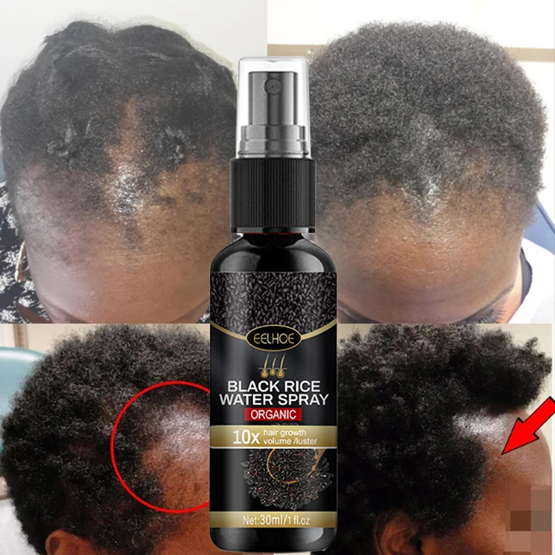 

Black Rice Hair Growth Spray Repairs Damage Restore Soft Hair For All Hair Types Fast Treatment Prevent Hair Thinning Dry Repair