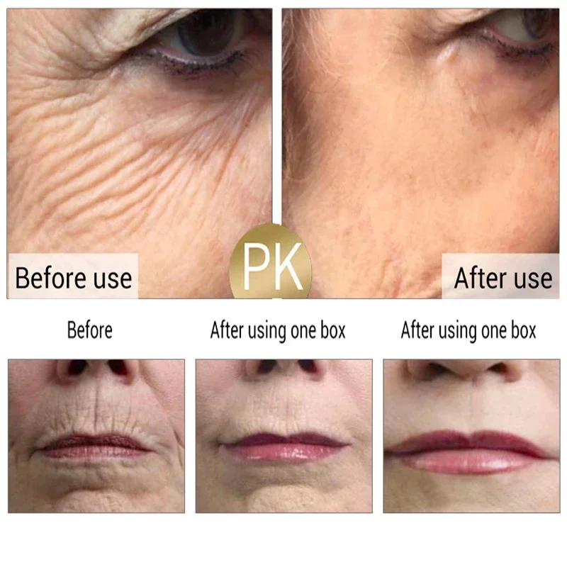 Face Set Instant Firming Lifting Anti-Aging Serum Fade Fine Lines Whitening Korean Skin Care Product 2