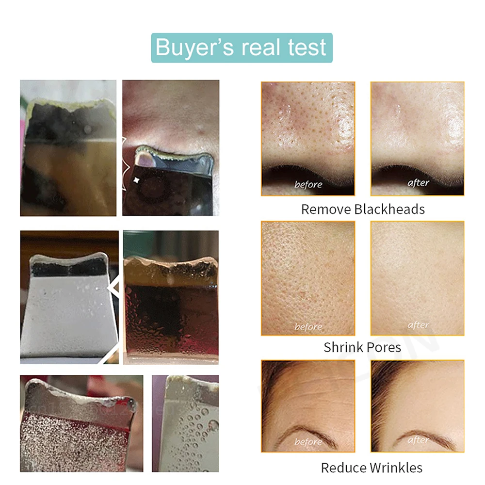 Facial Cleaner Ultrasonic Skin Scrubber Blackhead Remover Deep Face Cleaner