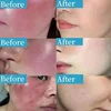 Repair Facial Redness Serum Instant Spider Vein Remove Sensitive Skin Sooth Anti Redness Rosacea Treat Lotion Korean Cosmetics 3