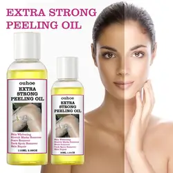 30ML Extra Strong Yellow Peeling Oil Whitening Lighten Elbows Knees Hands Even Skin Tone Whiten Skin Care