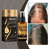 46218-df70ae.jpg Biotin Fast Hair Growth Spray Anti Hair Loss Serum Prevent Baldness Treatment Scalp Beard Beauty Essence Hair Care Products 30ml