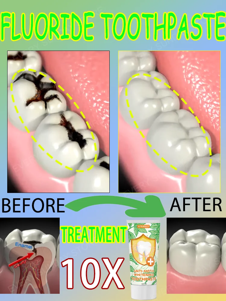 Clean cavities, whiten teeth, remove plaque, treat periodontitis, freshen breath, and let the whole family have good teeth