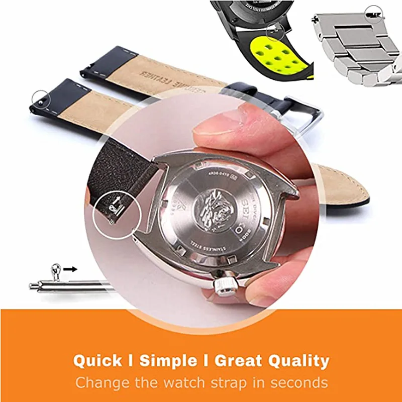 Stainless Steel Quick Release Watch Band Pins - 20 Pack, 1.5mm Diameter