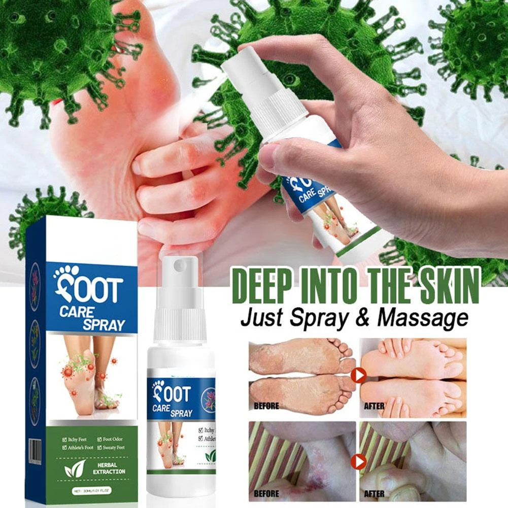 30ml Foot Deodorant Spray Relieve Itching Eliminate Athlete's Foot Moisturize Removal Care Odor Anti-Swea B9M2