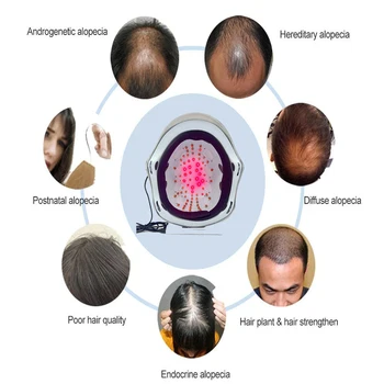 LLLT infared laser helmet hair growth for mens