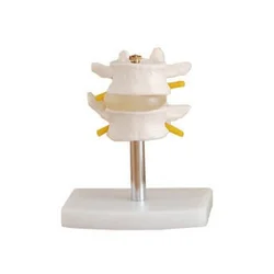 Modelo Normal de columna Lumbar (dos secciones)
