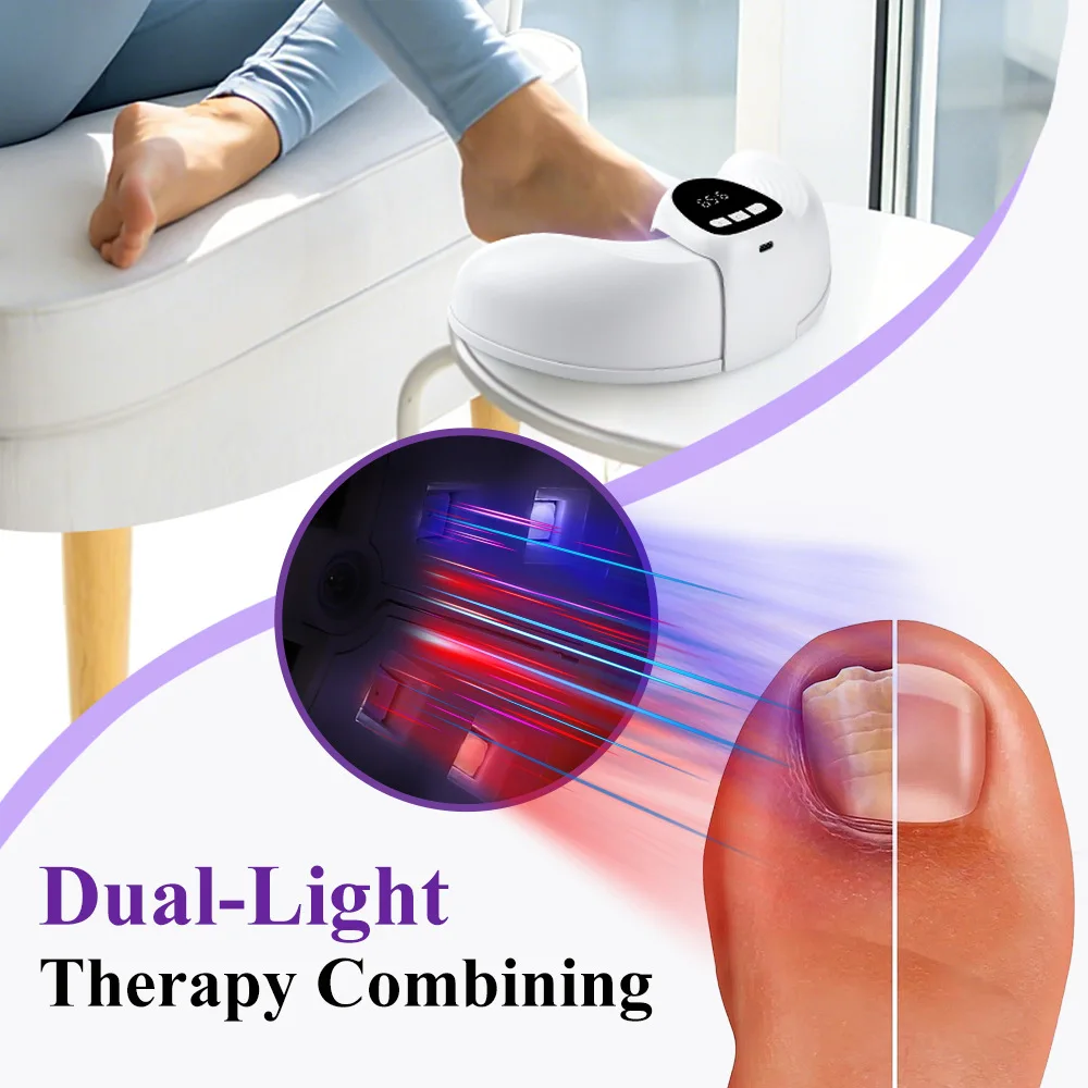 Appareil de traitement laser rechargeable pour mycose des ongles_voghion.com