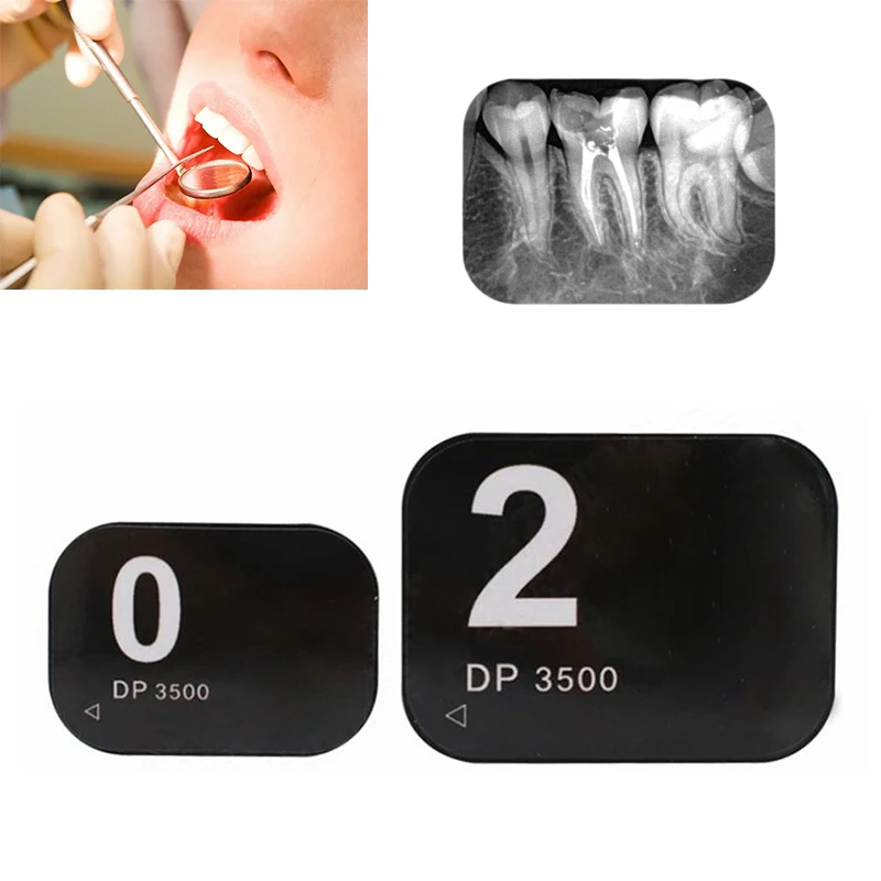 DentalPhosphorPlateIPBoardforDigitalDentalImagingPlateScanner