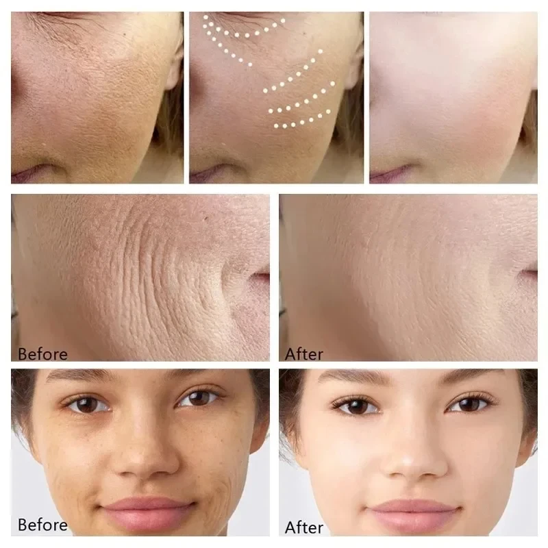 Wrinkle Remove Serum Anti-Aging Essence Fade Fine Line Lifting Firming Whitening Skin Care 3