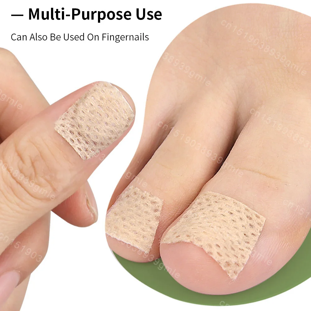 10/100Pcs Fungal Nail Patches Toenail Fingernail Repair Patch Nail Ingrown Correction Sticker Discolored Damaged Nail Feet Care