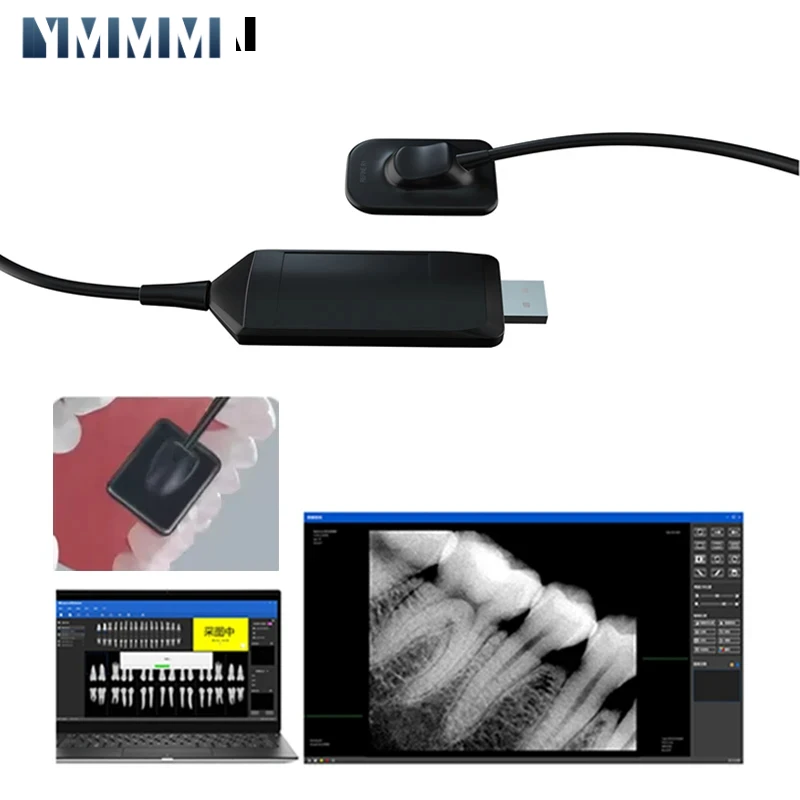 

Стоматологические цифровые камеры, стоматологический рентгеновский датчик, высокочастотная цифровая Интраоральная цифровая система Rx, инструменты для изображения H D