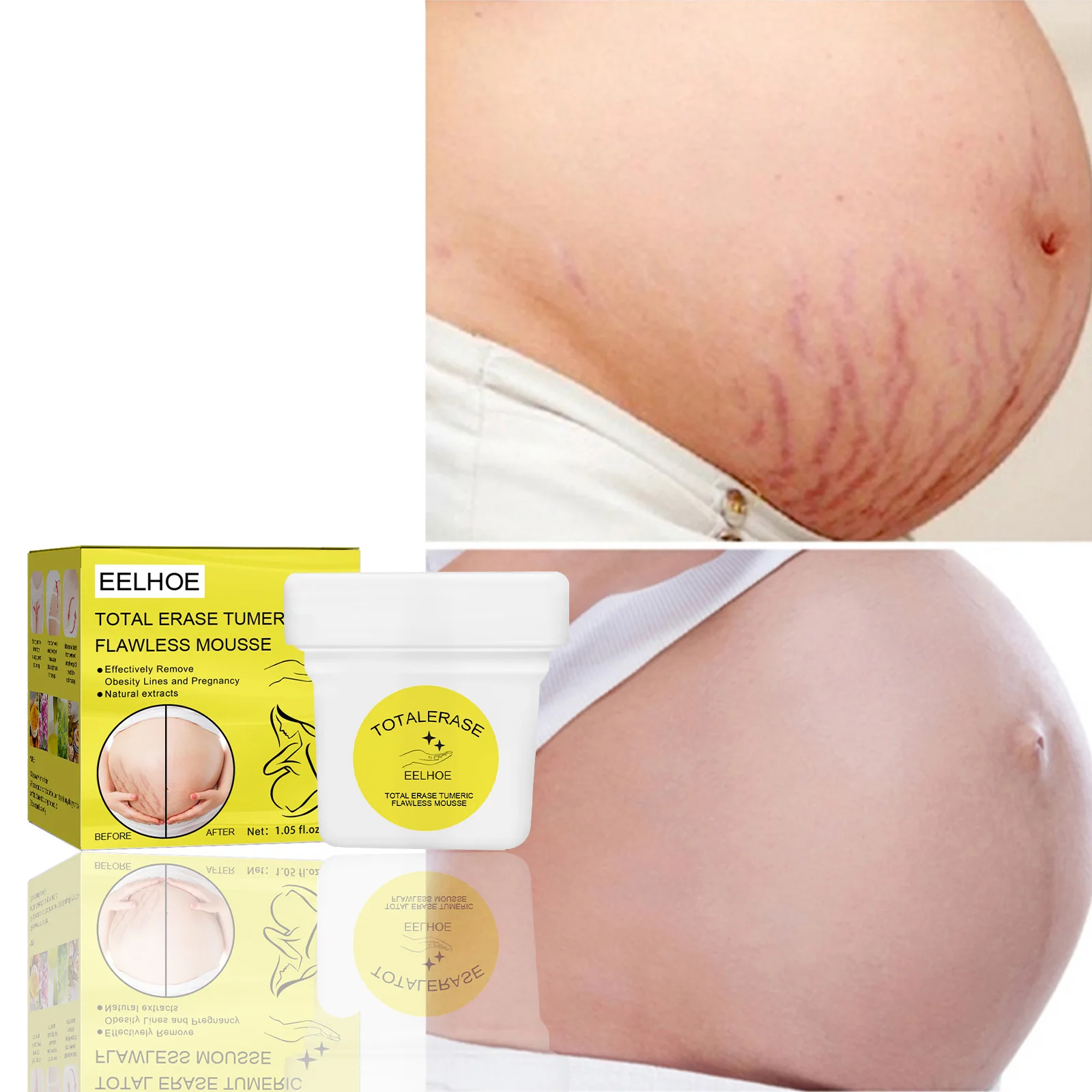 

Pregnancy Cream Repair Cream Desalination Prevention Fat Lines Growth Lines Orange Peel Lines Belly Firming Cream