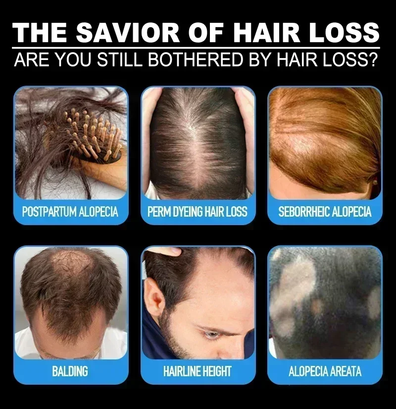 Hair Growth Essential Loss Regrowth Treatment Strengthens Hair Nourishes Scalp Light Weight Non Greasy Improve Scalp Circulation
