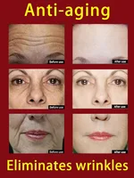 Retinol Anti-Wrinkle Cream Anti-Aging Firming Lifting Fade Fine Lines Deep Hydration Instant Smoothing Korean Skincare Cream 40g 2