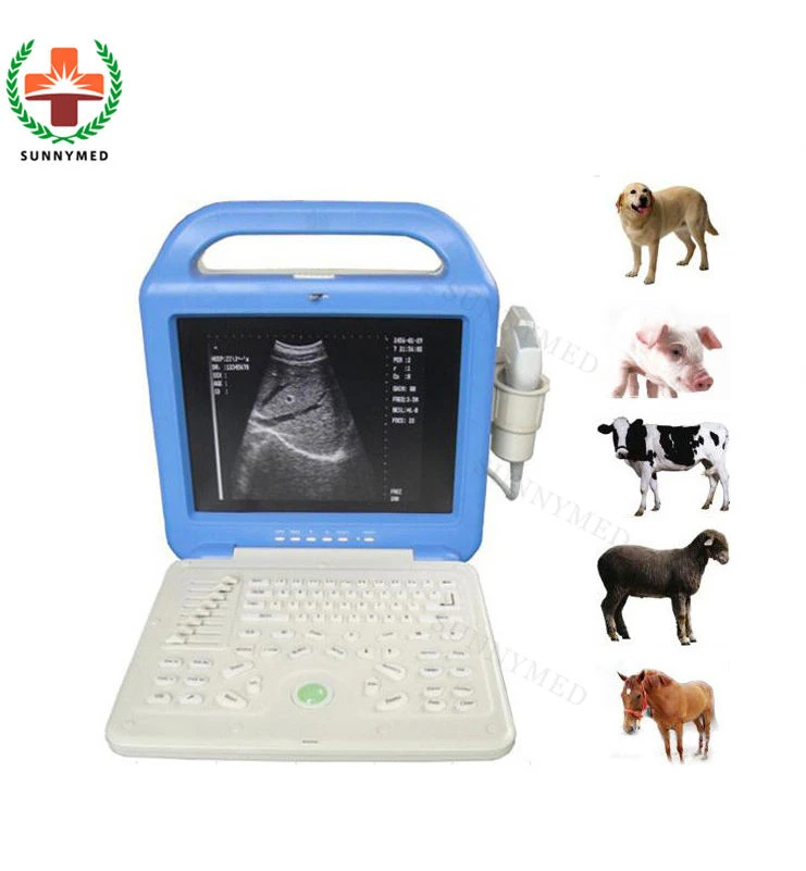 

51353A Health medic BW Medical diagnosis ultrasound machine portable Digital Laptop ultrasound machine