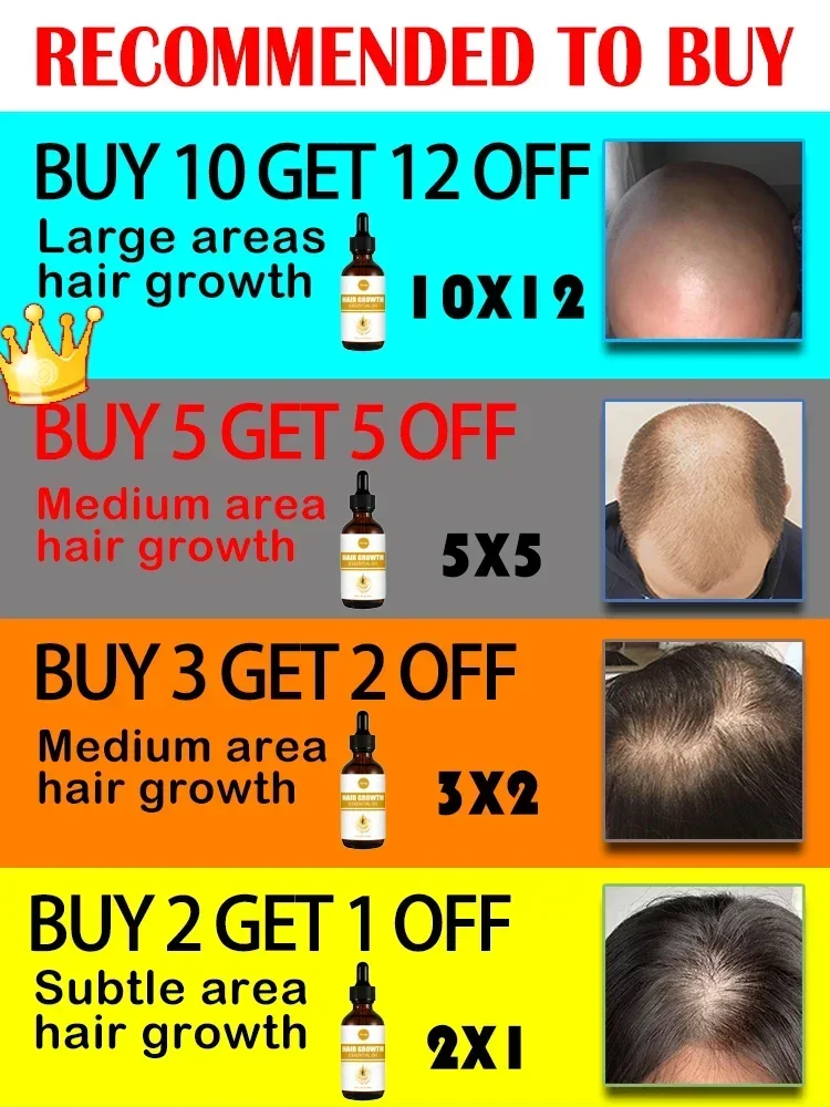 Essential oils that promote rapid hair growth and treat baldness and hair loss 2