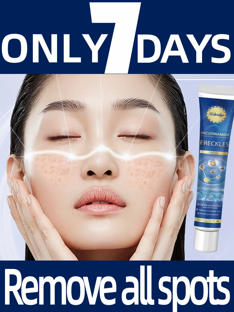 

freckles removal dark spots remover cream