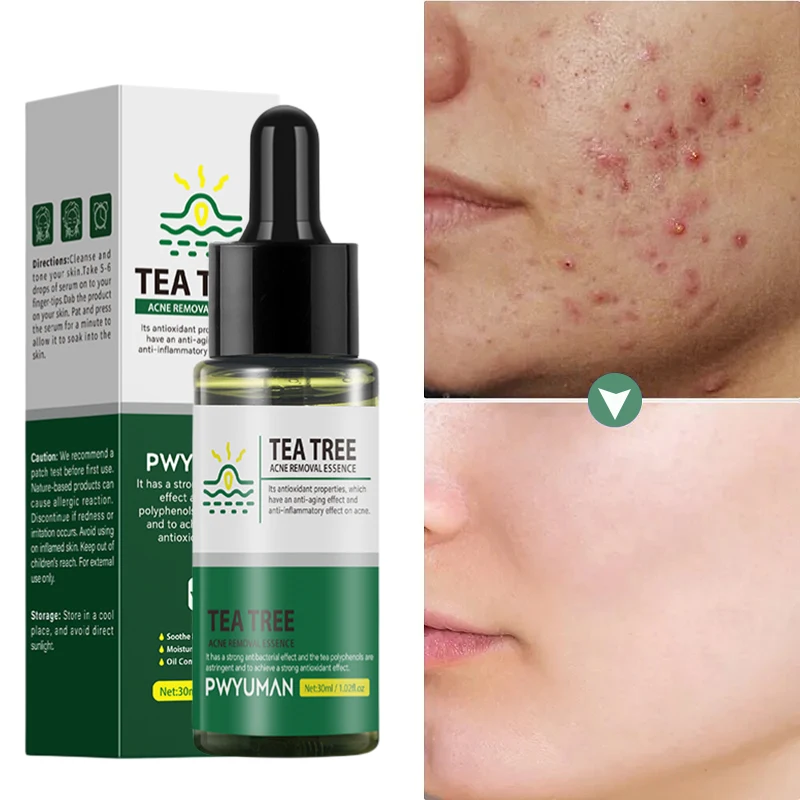 Tea Tree Oil Facial Pimple Remover Serum Acne Removal Beauty Pore Minimizer Face Lifting Firming Korean Skin Care Product 30ml hyaluronic acid face serum moisturizing anti aging snail essence pore minimizer acne treatment serum facial skincare 5ml