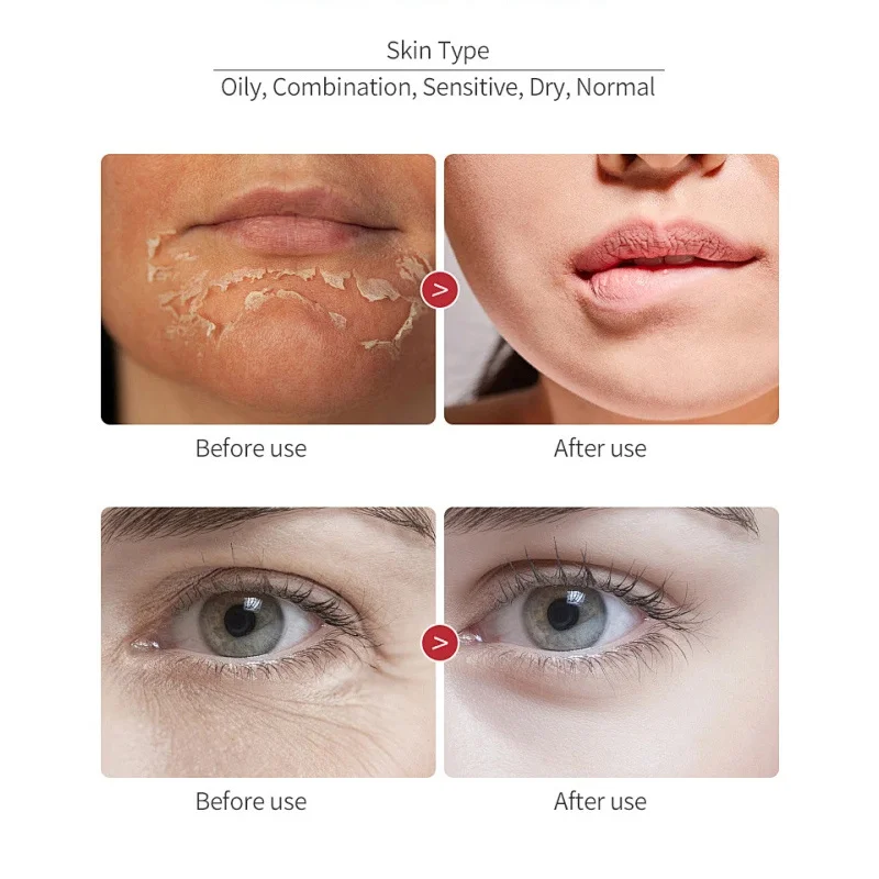 Dragon Blood Wrinkle Remover Face Set Instant Firming Lifting Anti-Aging Serum Fade Fine Line Whitening Korean Skin Care Product 3