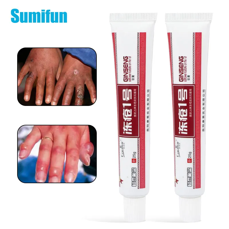 

25 г, антирастрескивающее искусственное замораживание ушей, рук, ног, замороженных трещин, снятие замораживания, отек, кожа, увлажняющий бальзам