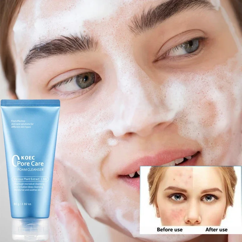Natural Moisturizing Facial Cream Coffee Retinol Aha Niacinamide Salicylic Acid Peach Essence Hydrating Koec Korean Skincare 6