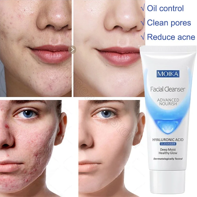 Facial Cleanser Facial Foam Cleanser Gentle Cleansing Pores Oil Control Blackhead Removal Whitening Moisturizing Korean Skin Care Products 80g