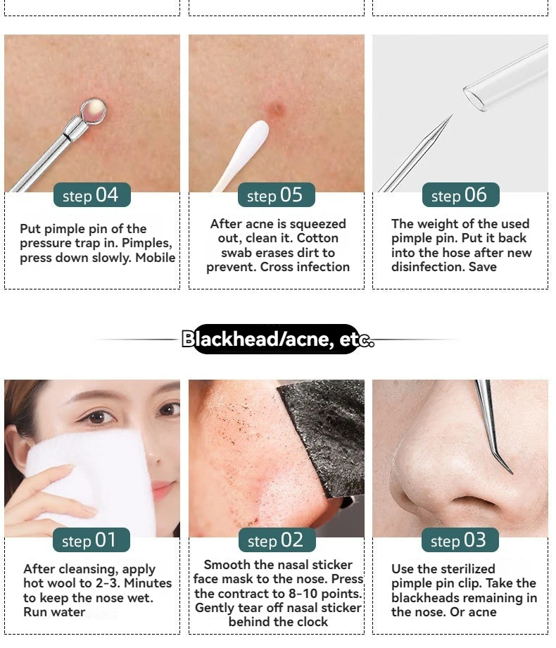 Acne Blackhead Needle Set Image 16
