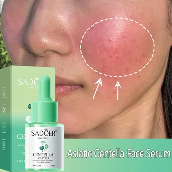 Siero Viso alla Centella Asiatica, Riduce il Rossore, Rassoda e Lifting, Attenua le Rughe, Sbiancante, Essenza per la Cura della Pelle