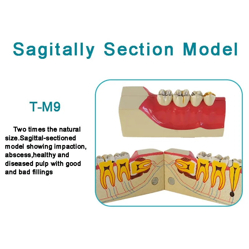 

Модель зубного пародонта, демонстрация кариеса, показ пробоя, показ периодонтита, обучающая модель зубов, коммуникация дантиста